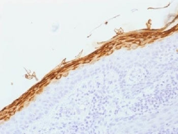 IHC testing of FFPE human skin with Filaggrin antibody (clone FLG/1562). Required HIER: boil tissue 
