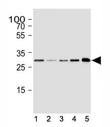 Western blot analysis of lysate from human (1) SH-SY5Y, (2) SK-BR-3, (3) HeLa cell line, (4) mouse b