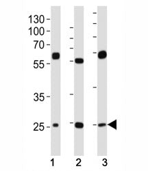 TFAM Antibody