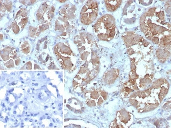 FABP1 Antibody / Fatty Acid Binding Protein 1