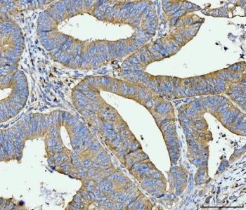 ACSL4 Antibody / FACL4