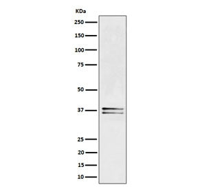 LAT Antibody / Linker for Activation of T cells