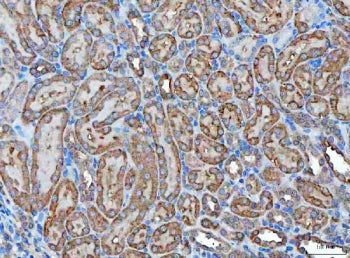 Klk7 Antibody / Kallikrein 7