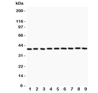 Western blot testing of APE1 antibody and Lane 1: rat NRK; 2: human HeLa; 3: rat PC12; 4: rat RH35; 