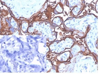 ALPP Antibody / Placental Alkaline Phosphatase