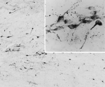 IHC testing of PFA-perfused cryosection of human hypothalamus and AGRP antibody at 0.05ug/ml. HIER: 