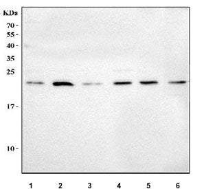 Western blot testing of 1) human A549, 2) human SiHa, 3) human ThP-1, 4) human U-251, 5) rat testis 