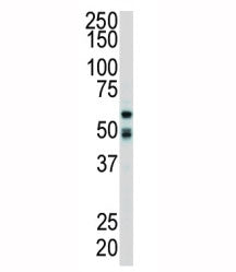 RIPK2 Antibody