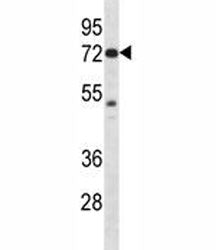 Pak4 Antibody