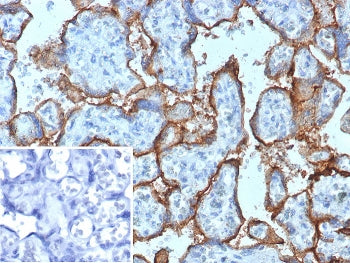 IHC staining of FFPE human placental tissue with CD168 / HMMR antibody (clone HMMR/8021). Inset: PBS