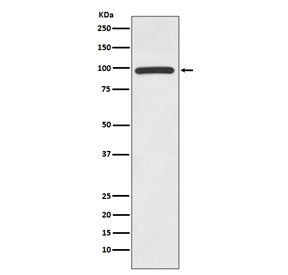 HMG CoA Reductase Antibody / HMGCR