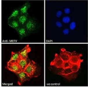MEFV Antibody