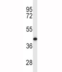MCL1 antibody western blot analysis in Y79 lysate. Predicted molecular weight: 37/29 kDa (isoforms 1