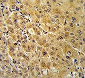 FKBP12 Antibody / FKBP1A