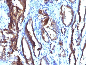 PSA / Prostate Specific Antigen Antibody
