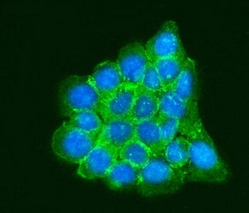 RPLP0 Antibody / 60S acidic ribosomal protein P0