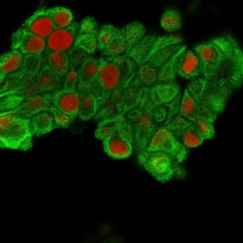 KRT19 Antibody / Cytokeratin 19
