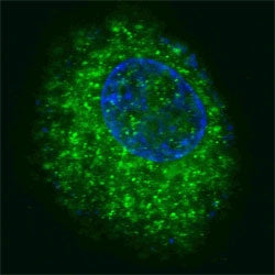 HGFR Antibody (MET)