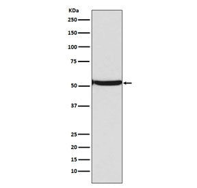 Acetyl-p53 Antibody (Lys382)