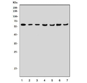 Western blot testing of 1) rat brain, 2) mouse brain, 3) mouse Neuro-2a, 4) human HEK293, 5) human J