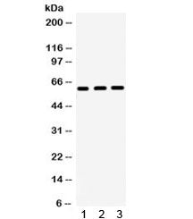 Western blot testing of 1) rat liver, 2) rat kidney, 3) human SW620 lysate with HNF1 beta antibody. 
