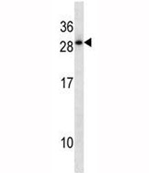 HOXD12 Antibody