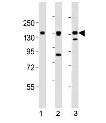 AXL antibody at 1:2000 dilution. Lane 1: NCI-H1299 lysate; 2: HeLa lysate; 3: L6 lysate; Predicted m