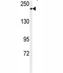 TRPM7 Antibody (CHAK1)