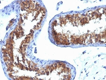MVP Antibody / Major Vault Protein