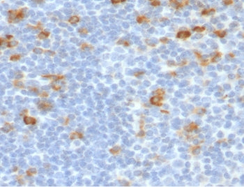 IHC testing of FFPE human tonsil stained with Kappa light chain antibody (clone KC3L-2). Required HI