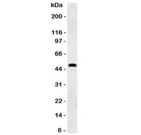 Western blot testing of human brain and GFAP antibody (clone GFA12-3). Predicted molecular weight ~5