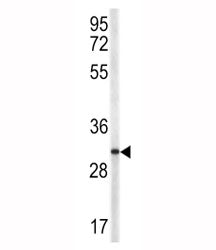 TRAP Antibody (CD40L)