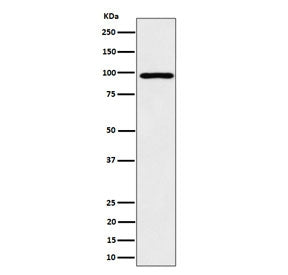 Western blot testing of human HepG2 cell lysate with AKAP8 antibody. Predicted molecular weight ~76 kDa but routinely observed at ~95 kDa.