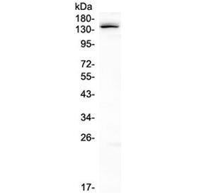 LATS1 Antibody