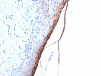 IHC testing of FFPE human skin with recombinant FLG antibody (clone FLG/1957R). Required HIER: boil 