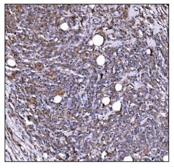 LILRB1 Antibody / LIR-1 / ILT-2