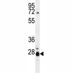 IL17B antibody western blot analysis in mouse spleen tissue lysate. Expected molecular weight: 17-20