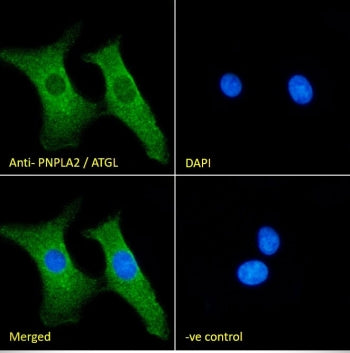 Adipose triglyceride lipase Antibody