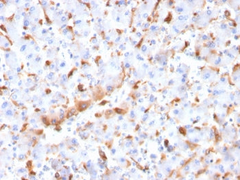 C1QB Antibody / Complement C1q B-Chain