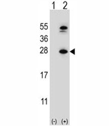 DHFR Antibody