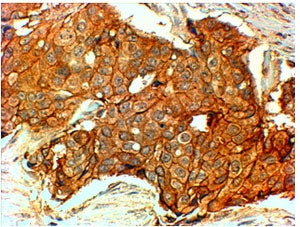 HER2 Antibody