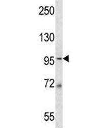 MCM6 Antibody