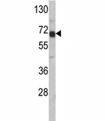 AFP Antibody