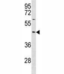 TXNIP Antibody