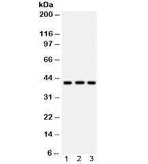 Western blot testing of 1) human U87, 2) human HepG2 and 3) mouse brain lysate with HLA-A antibody. 