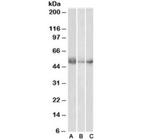 Western blot testing of human lymph node (A), spleen (B) and placenta (C) lysates with IDO antibody 