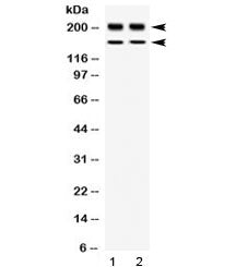 Western blot testing of 1) rat thymus and 2) human placenta lysate with WRN antibody at 0.5ug/ml. Ob