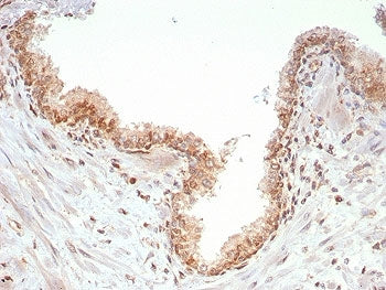 SMAD4 Antibody