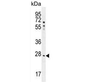 NR0B2 Antibody