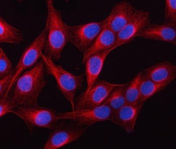 Beta Tubulin Antibody / TUBB1